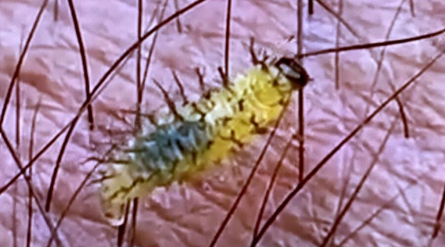 Lagarta de Larva Coleoptera na Pele. Quintal Alto, Adubeira, Garagem, Tigüéra 360, Juiz de Fora, Minas Gerais/MG, Brasil. Registro de Capoeira Mestre Polêmico - Professor João Couto Teixeira. IMG_5202. 214,8 MB. 07h27. Terça-feira, 14 de Março de 2023. HD 1080p. Universidade Livre de Estudos Culturais da Capoeira - Universidade da Capoeira - UNICAPOEIRA, Instituto de Educação Socioambiental - IESAMBI, Associação de Capoeira - ASCA e Grupo de Capoeira MEIA LUA - Fundado Terça-feira, 29 de Maio de 1962.